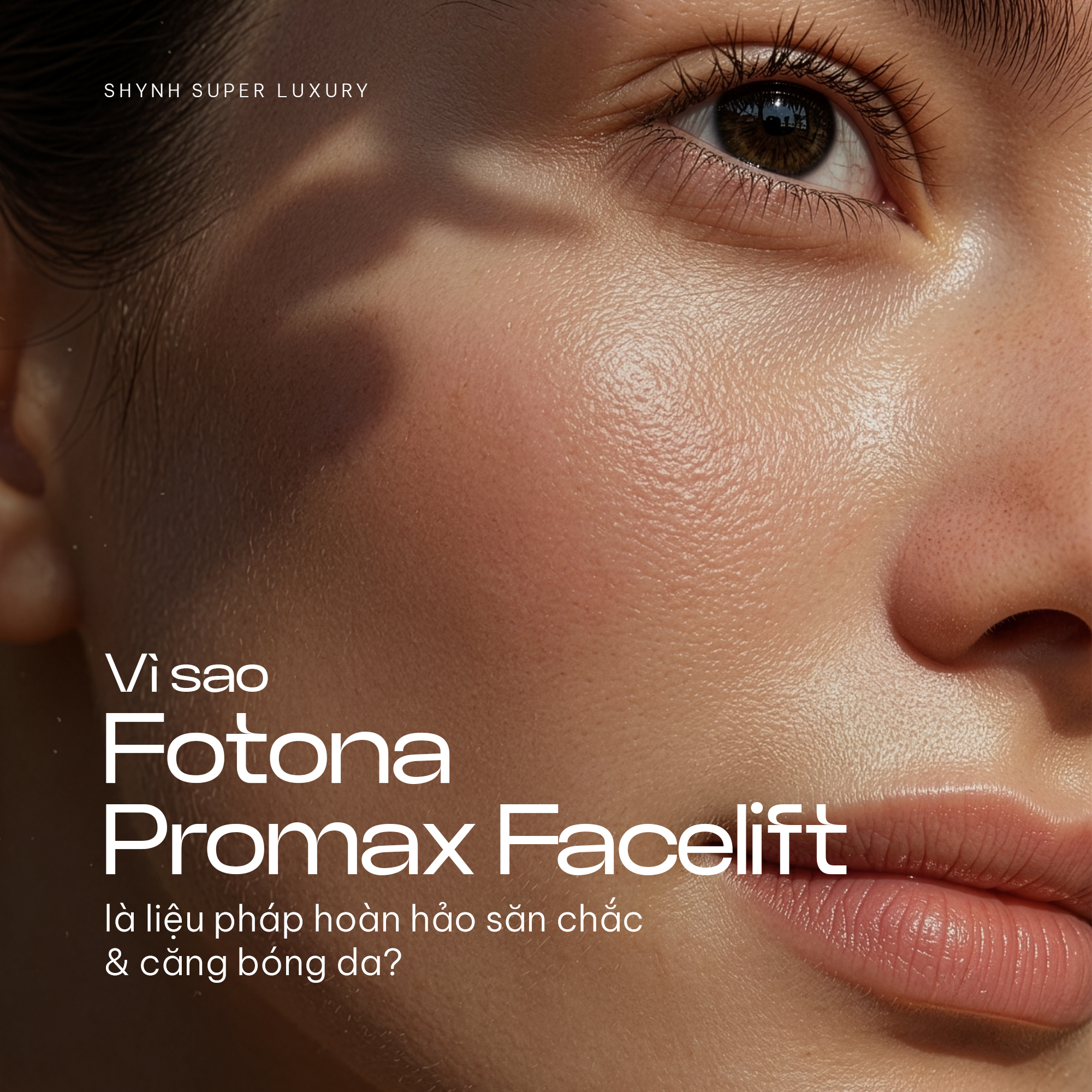 Shynh Super Luxury - Healthcare & Wellness Center Facebook ad: VÌ SAO FOTONA PROMAX FACELIFT LÀ LIỆU PHÁP…