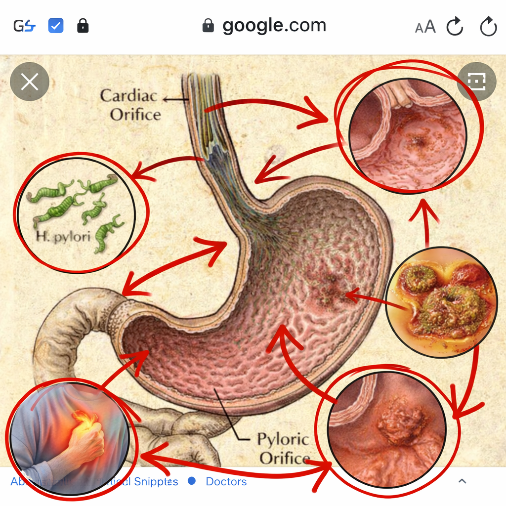 My Esophagus and Me Facebook ad