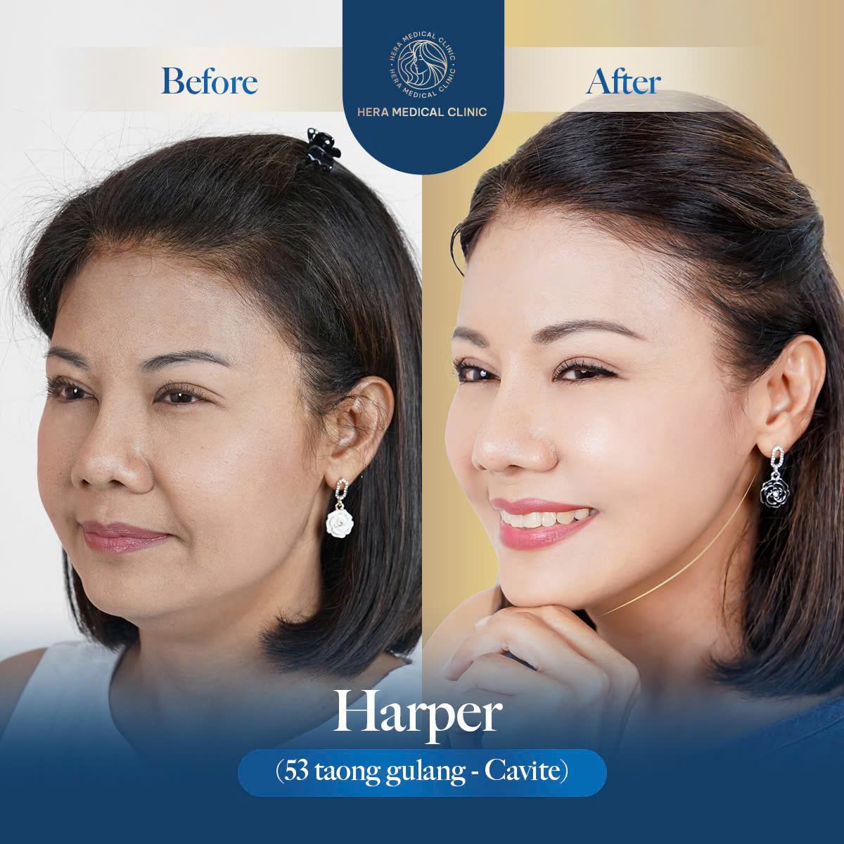 Hera Medical Clinic Facebook ad: Message us to consult with our doctors