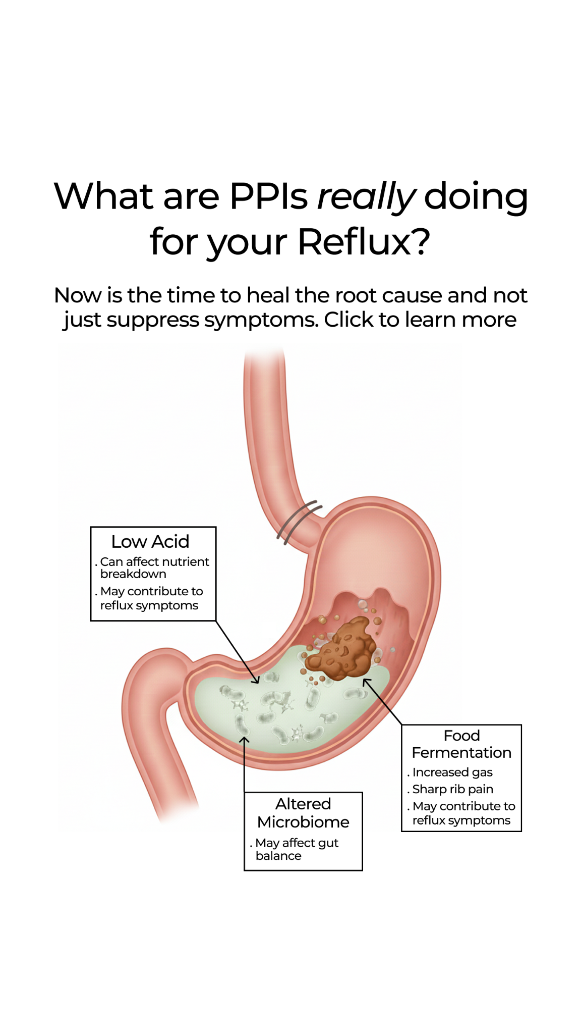 FOCUL Facebook ad