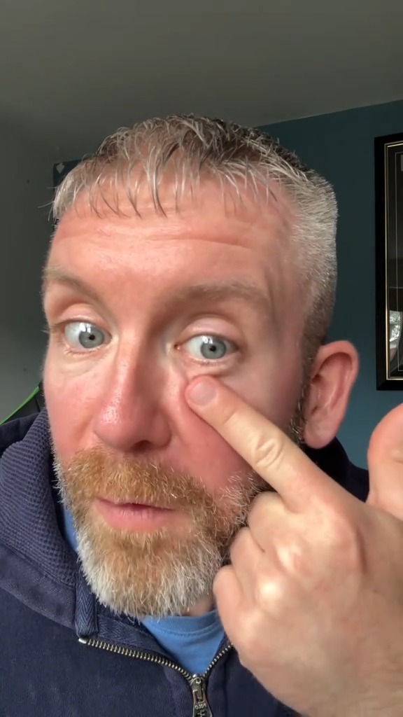K-Beauty Crush Facebook ad: I instantly fixed my dad’s saggy eye bags!