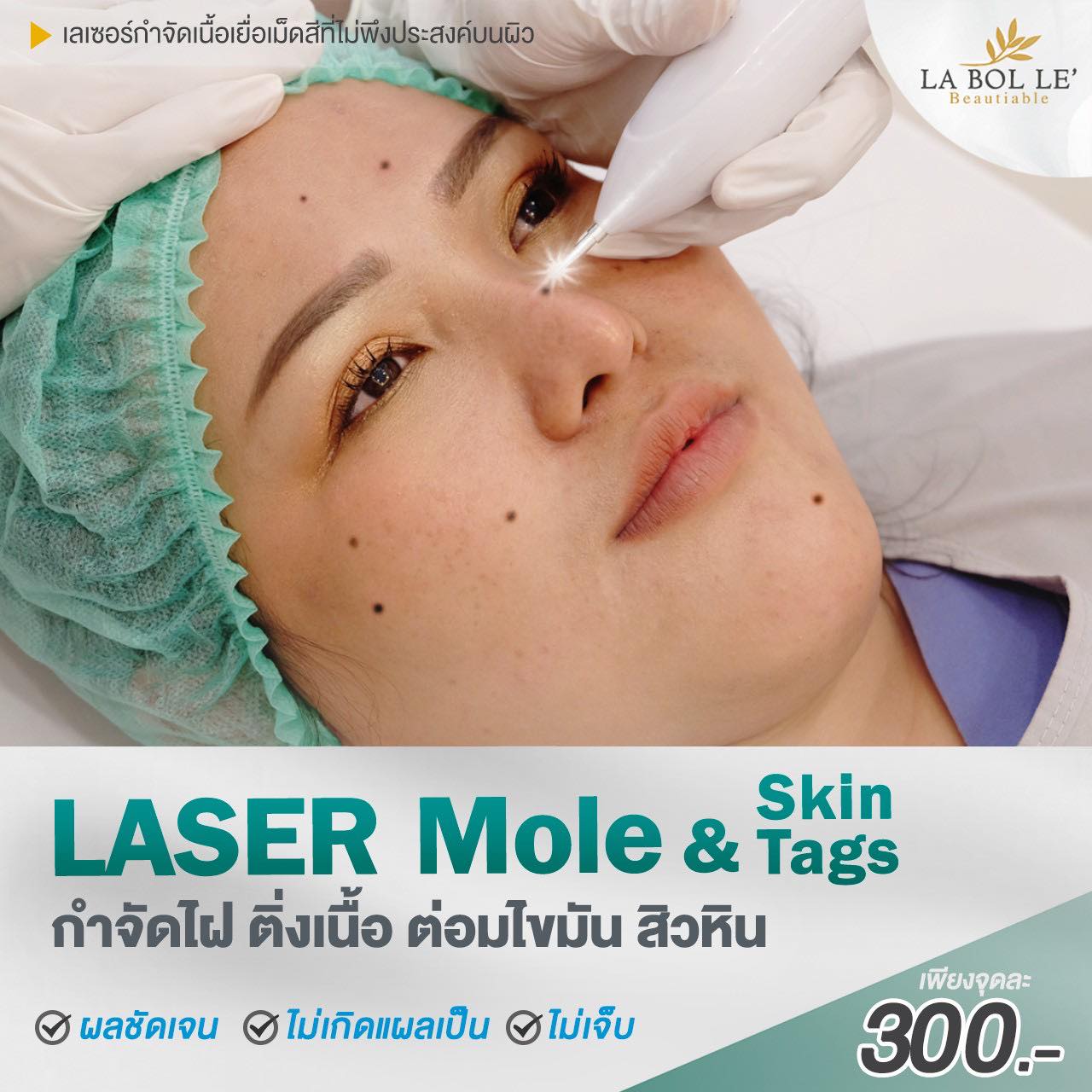 Labolle' Clinic ลาโบลเล่ คลินิก ลาดพร้าว 116 Facebook ad: 𝐋𝐚𝐬𝐞𝐫 กำจัดไฝ ติ่งเนื้อ กวนใจ