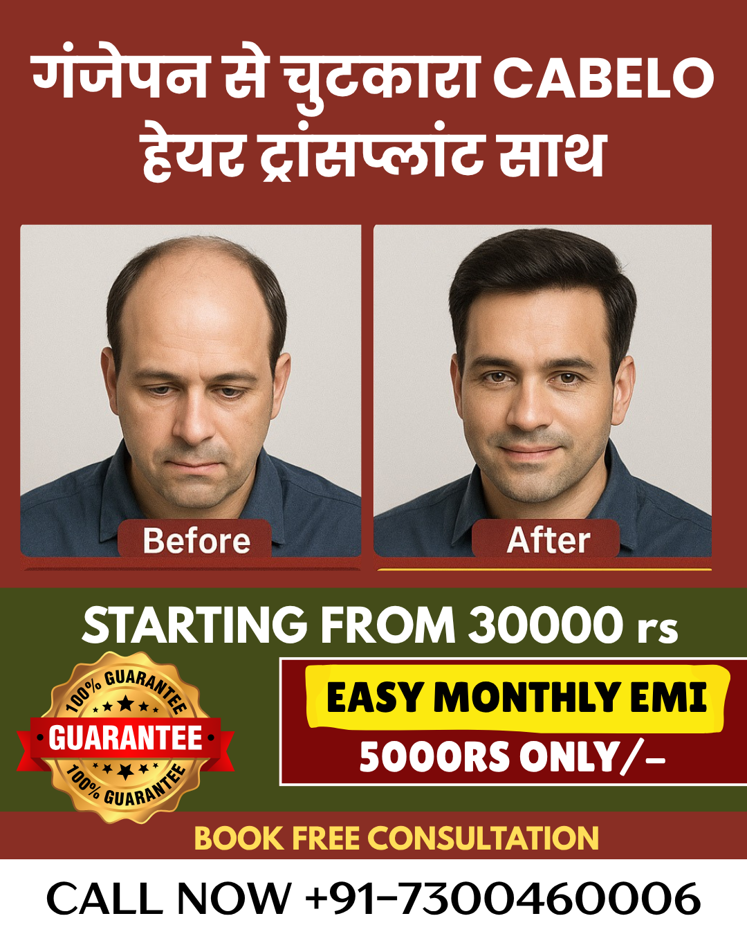 Best Hair Transplant in Rajasthan Facebook ad from Apr 10, 2026