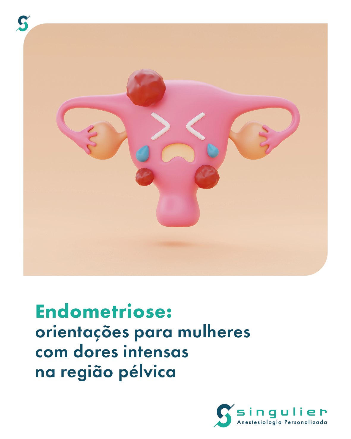 Singulier - Anestesiologia Personalizada Facebook ad: A endometriose é uma doença silenciosa que afeta…