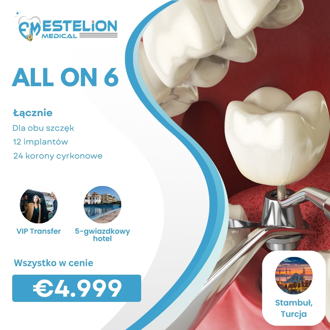 Estelion Dental Facebook ad: Kompleksowy pakiet all-inclusive zapewniający ekskluzywne…