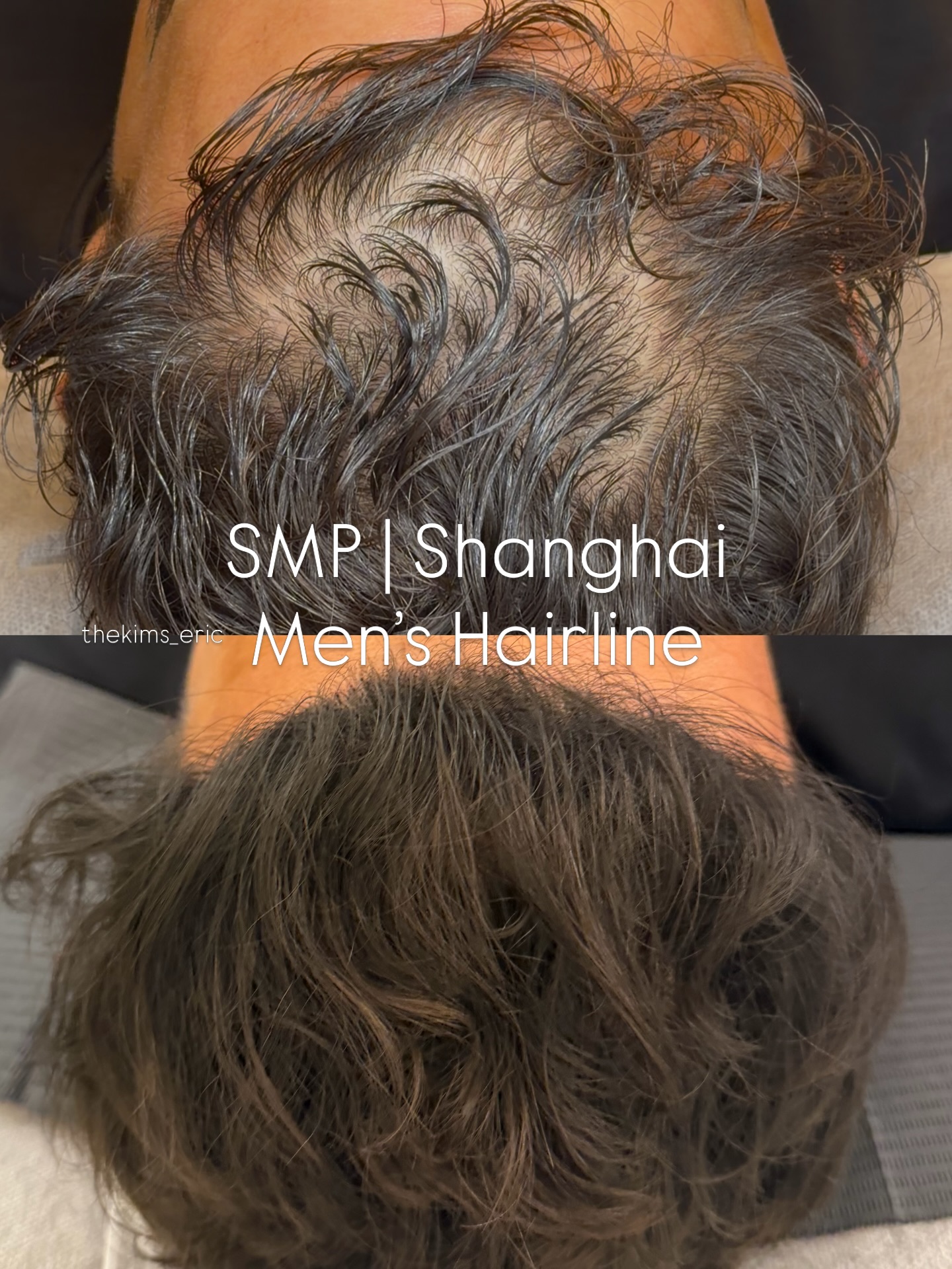 thekims_eric Facebook ad: Scalp Micropigmentation | Shanghai
