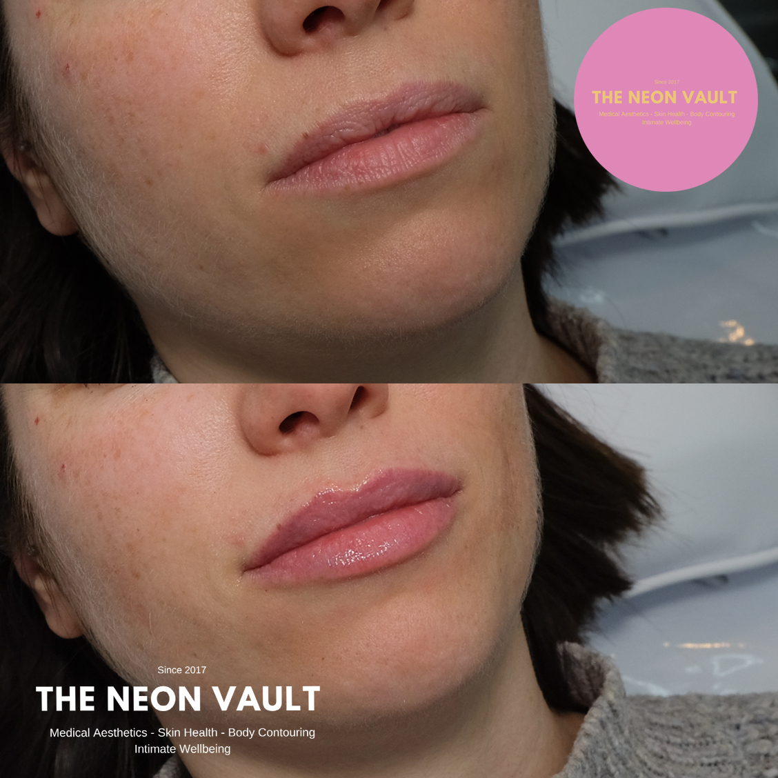 The Neon Vault Facebook ad