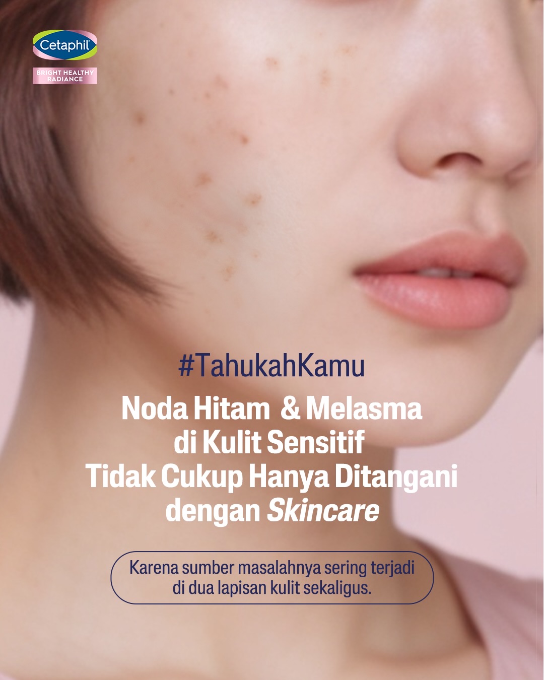 Cetaphil Facebook ad