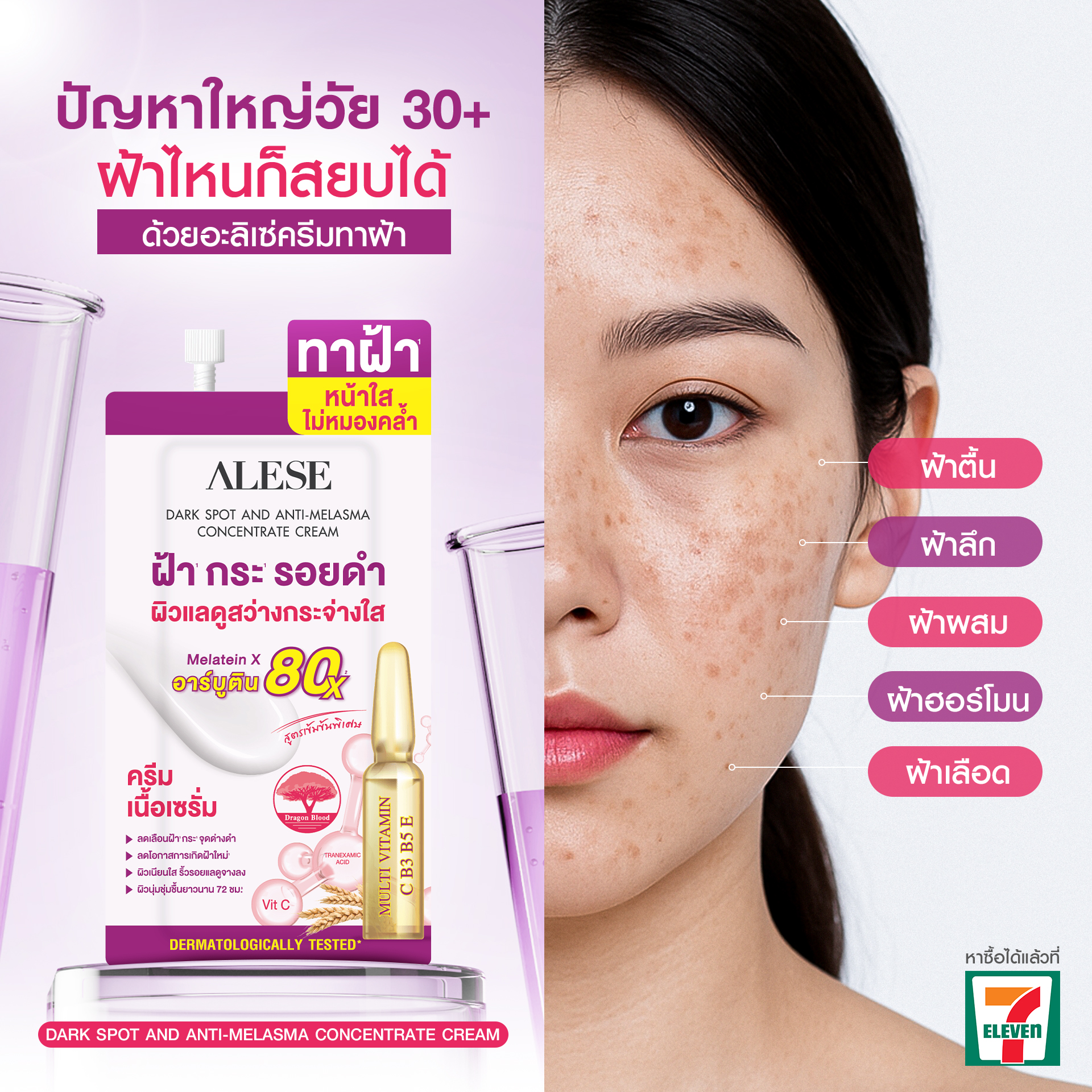 Alese Thailand Facebook ad: ปัญหาใหญ่วัย 30+ ทั้งฝ้าตื้น ฝ้าลึก ฝ้าผสม ฝ้าฮอร์โมน…