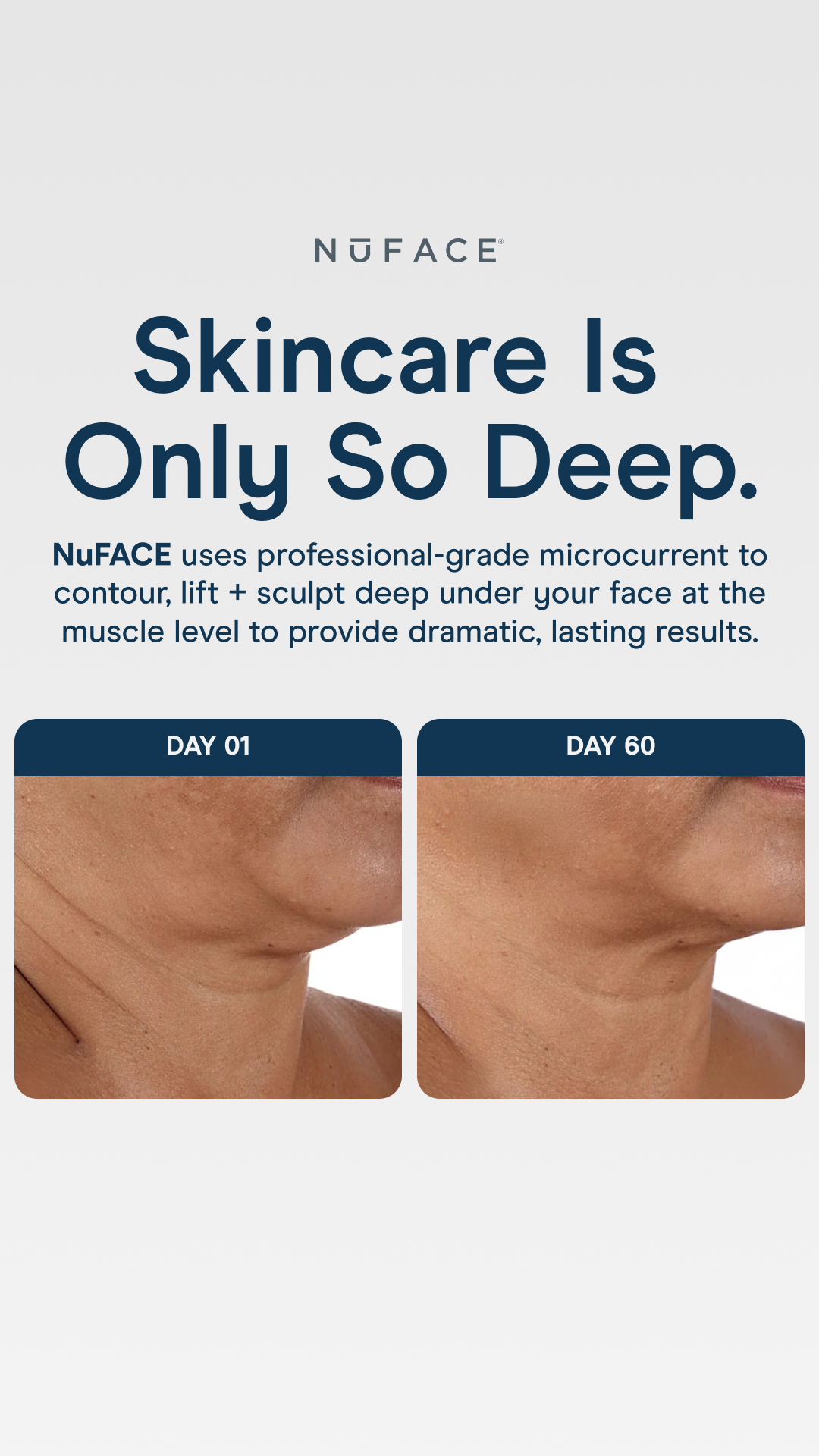 NuFACE Facebook ad