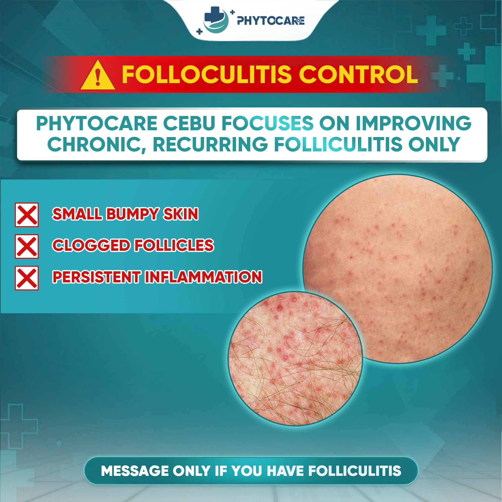 Cebu Phytocare Skin Clinic Facebook ad