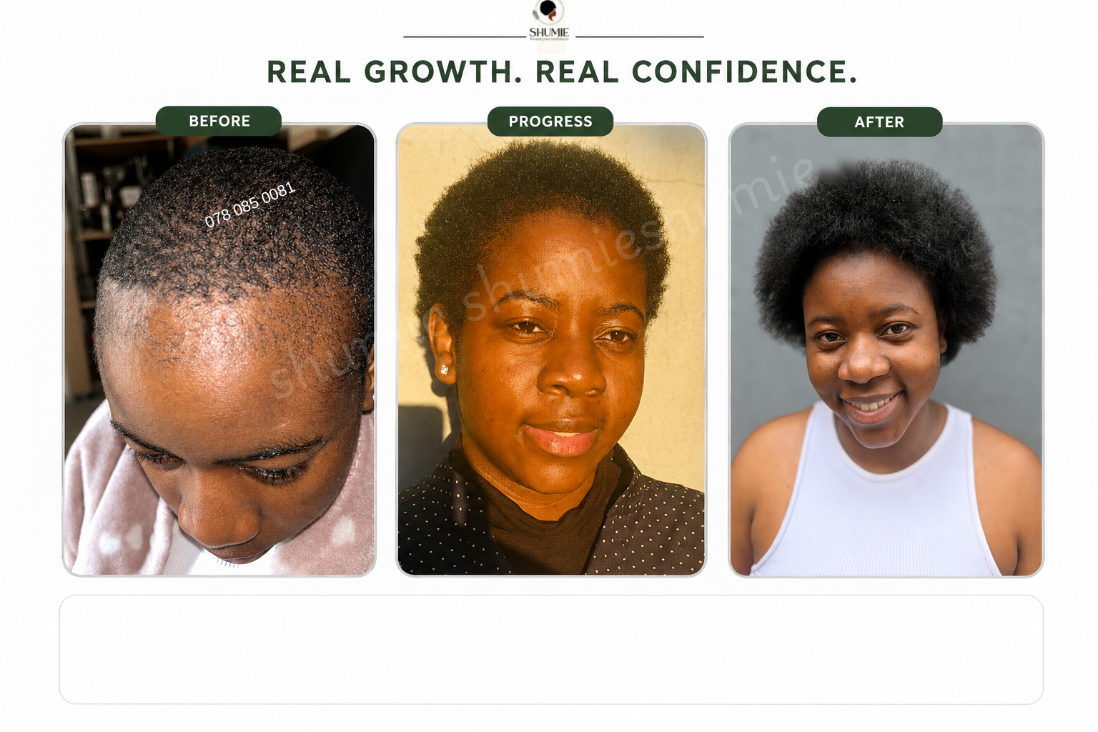 Shumie Facebook ad: Restore Your Hairline Confidence
