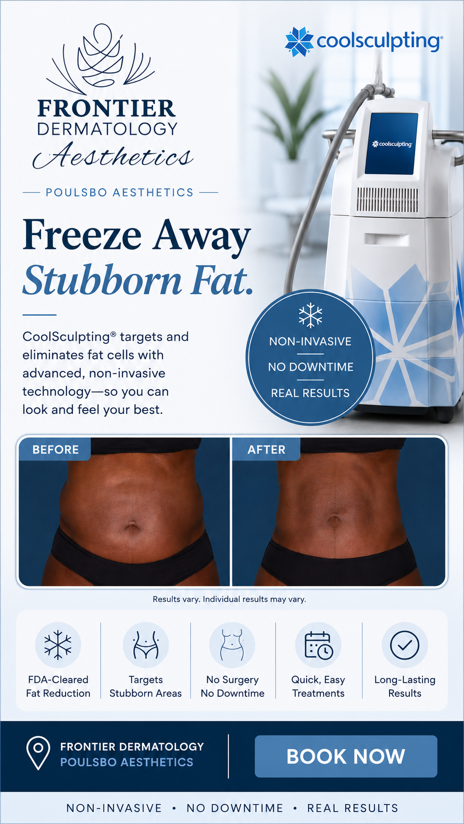 Frontier Dermatology Facebook ad from May 28, 2026