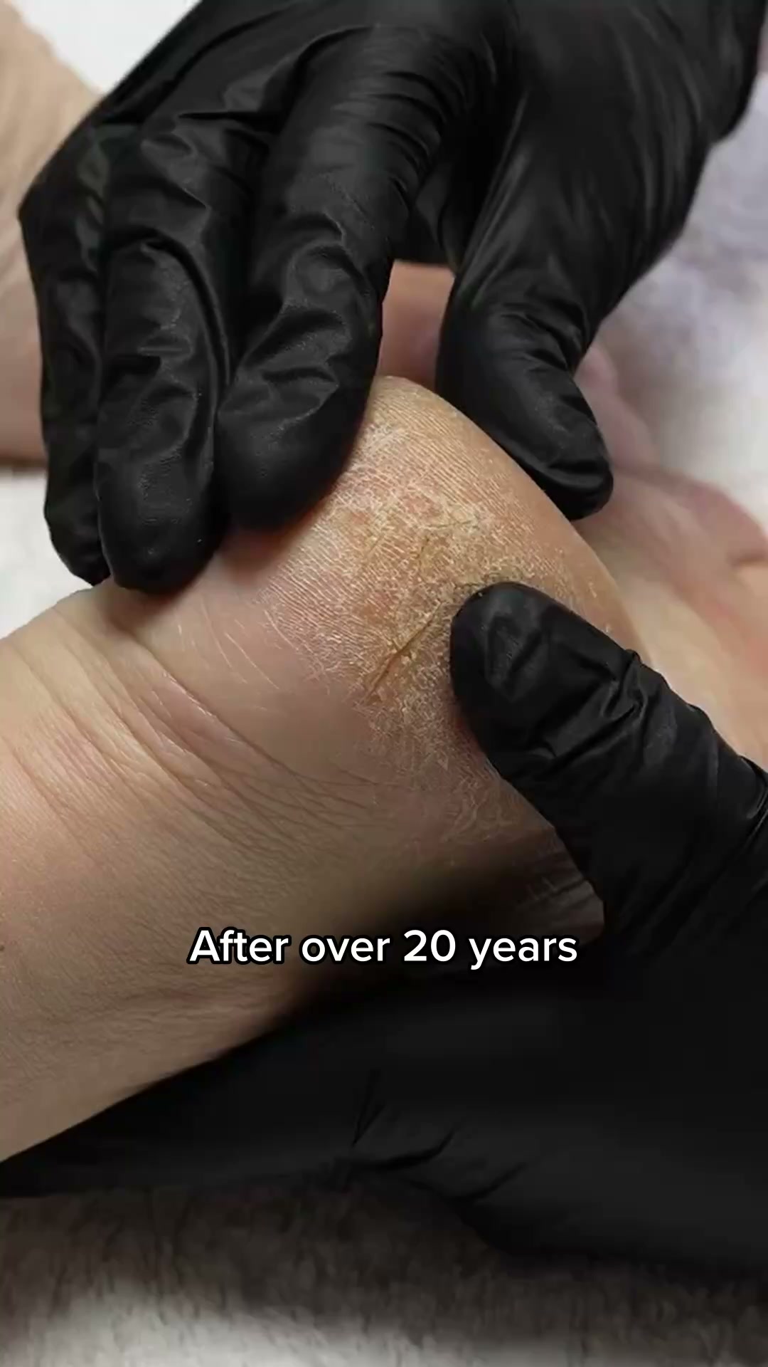 Skinmore Magazine Facebook ad: Baby soft feet in 5 minutes flat