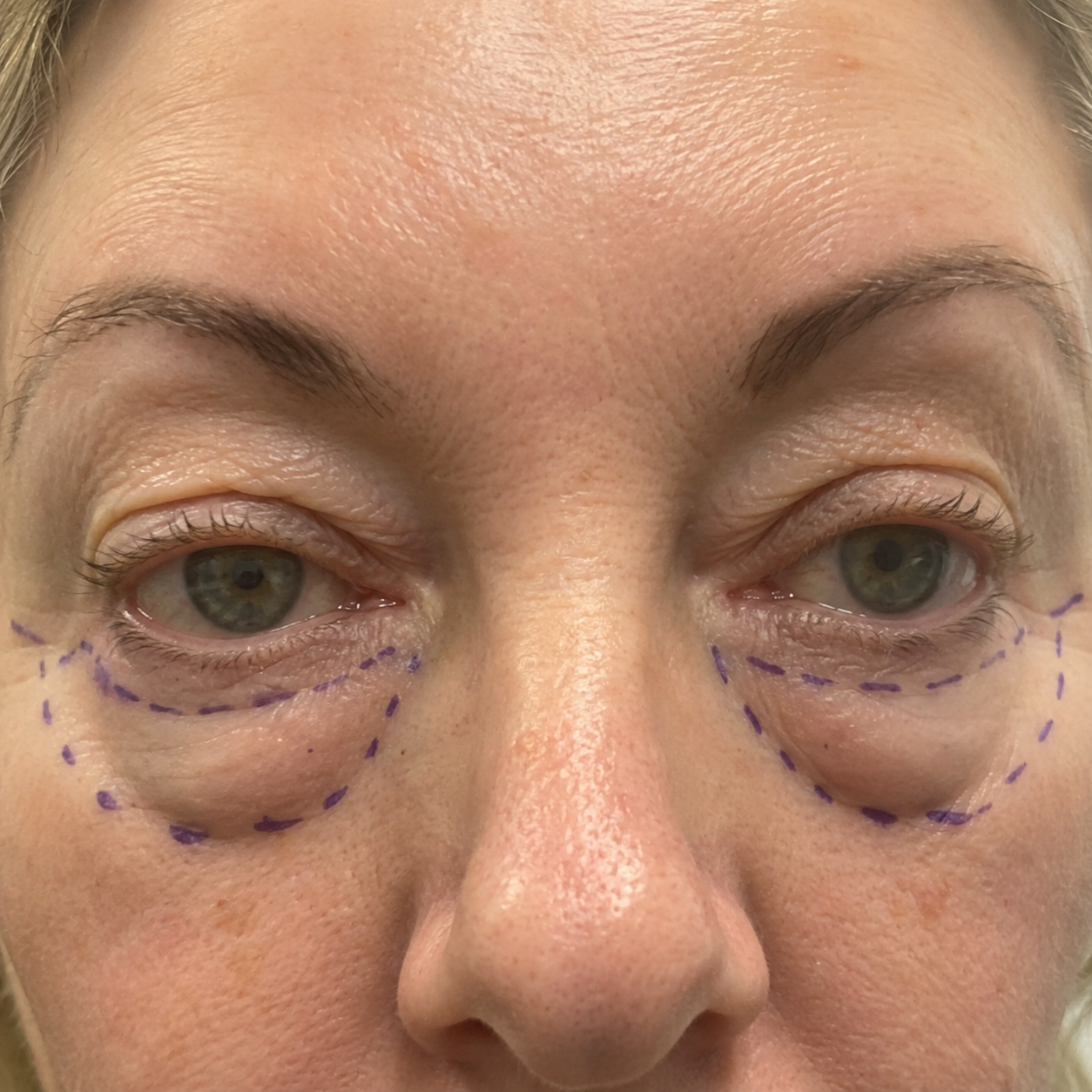 Dr. Amelia Whitmore Facebook ad: A Retired Eye Surgeon Finally Speaks Up
