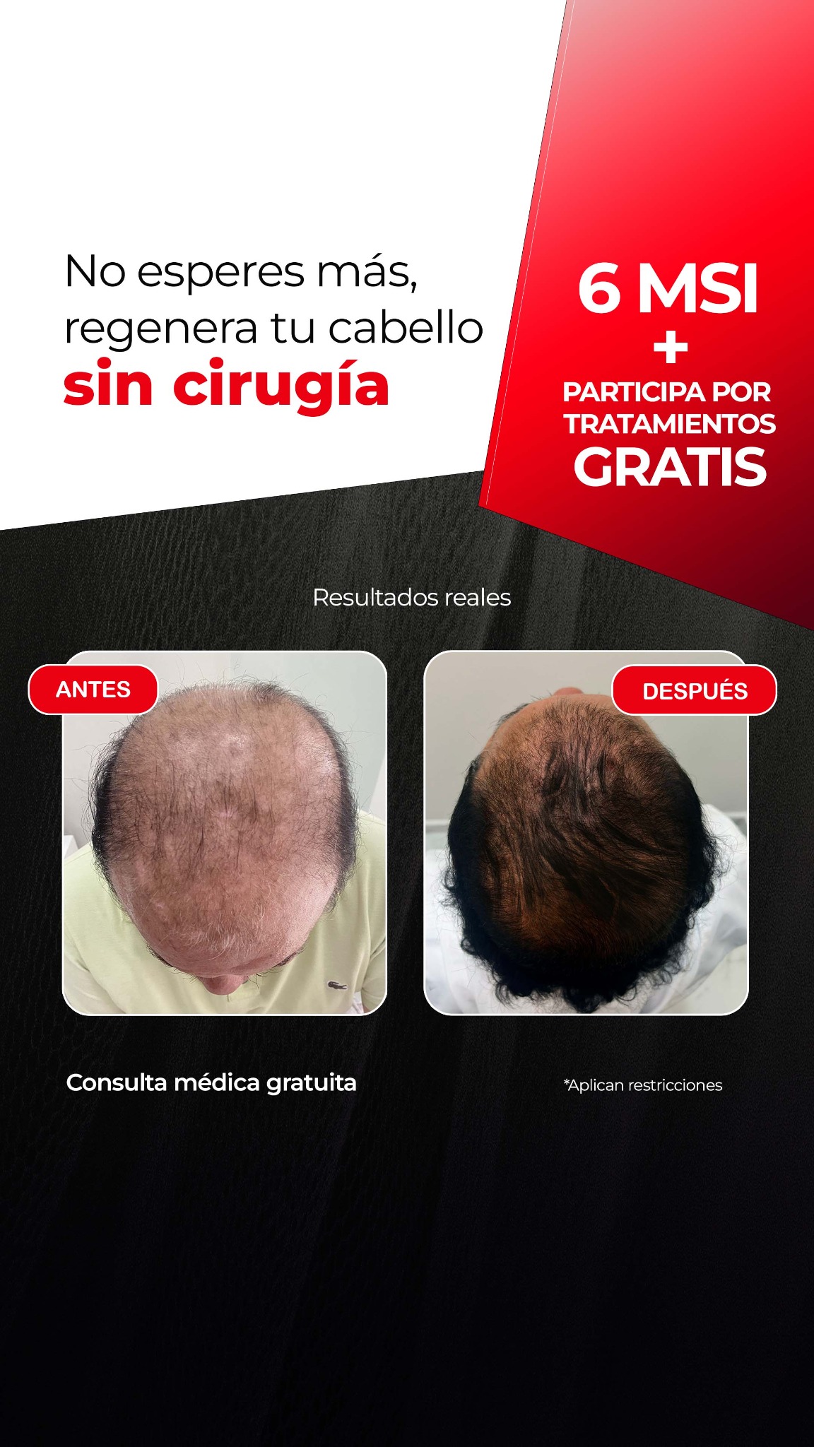 Injerto Capilar Metepec - CDMX Facebook ad from Mar 9, 2026