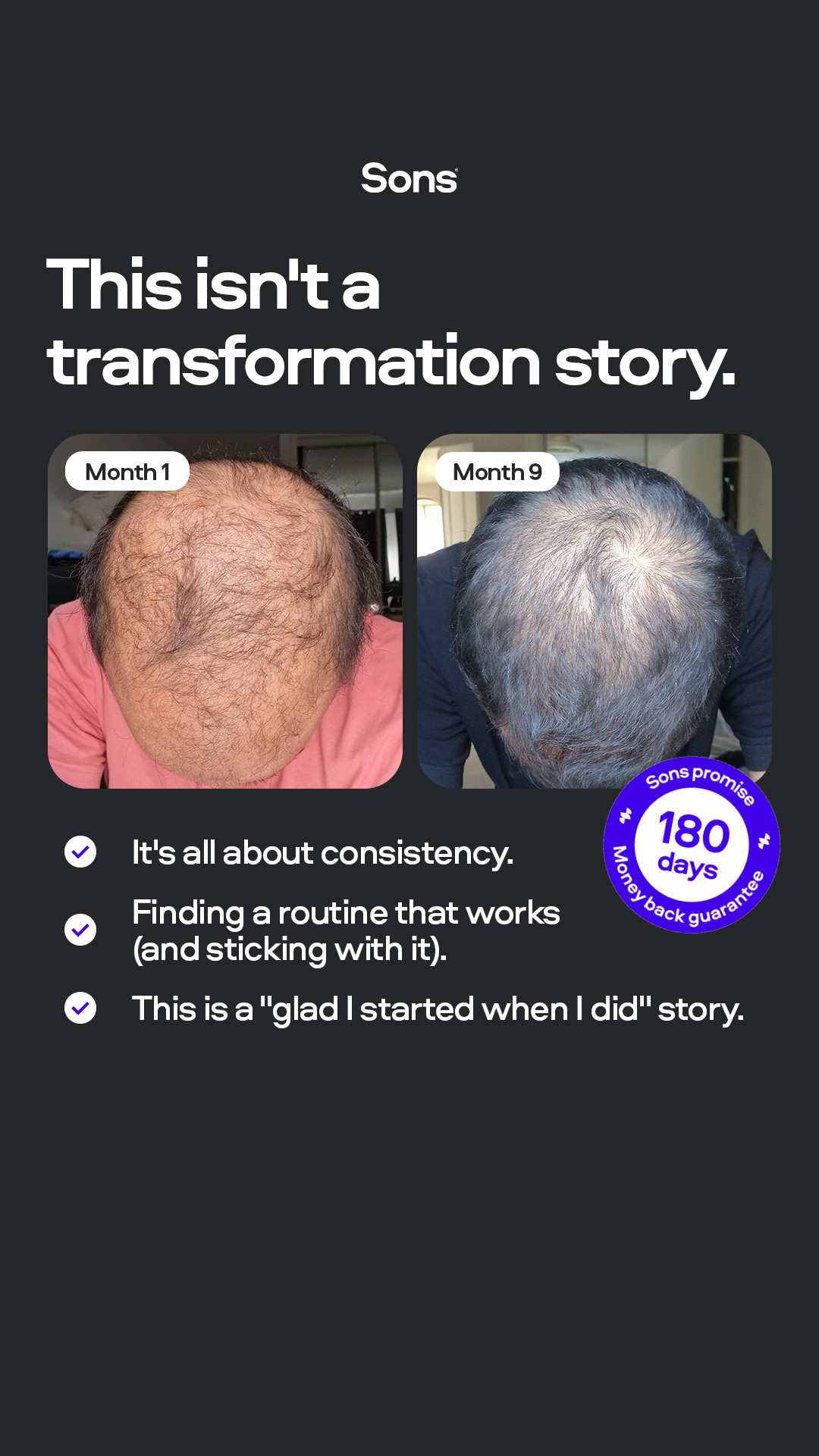 Sons Facebook ad: Your hairline. Your call.