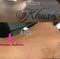 Riyaanz Aesthetic Laser Tattoo Removal