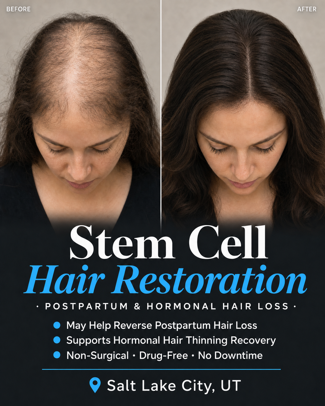 Utah Trim & Wellness Clinic Facebook ad: Thicker, Fuller Hair Without Drugs or Surgery