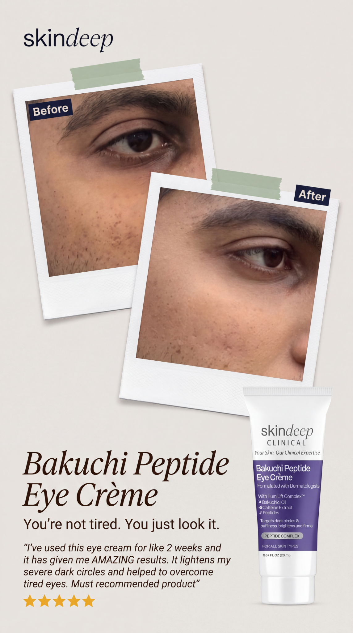 Skin Deep Facebook ad
