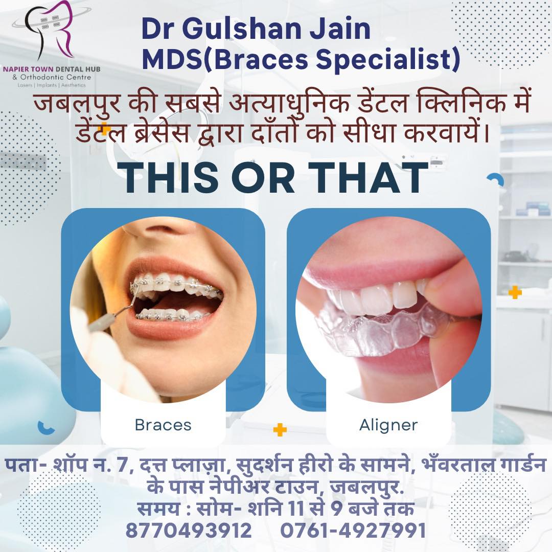 Napier Town Dental Hub & Orthodontic Center Facebook ad: आड़े टेडे एवं बाहर निकले हुए दांतों को…