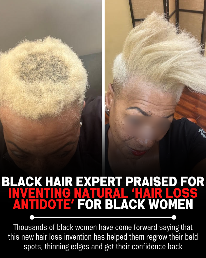 Black Hair Growth Remedy Facebook ad