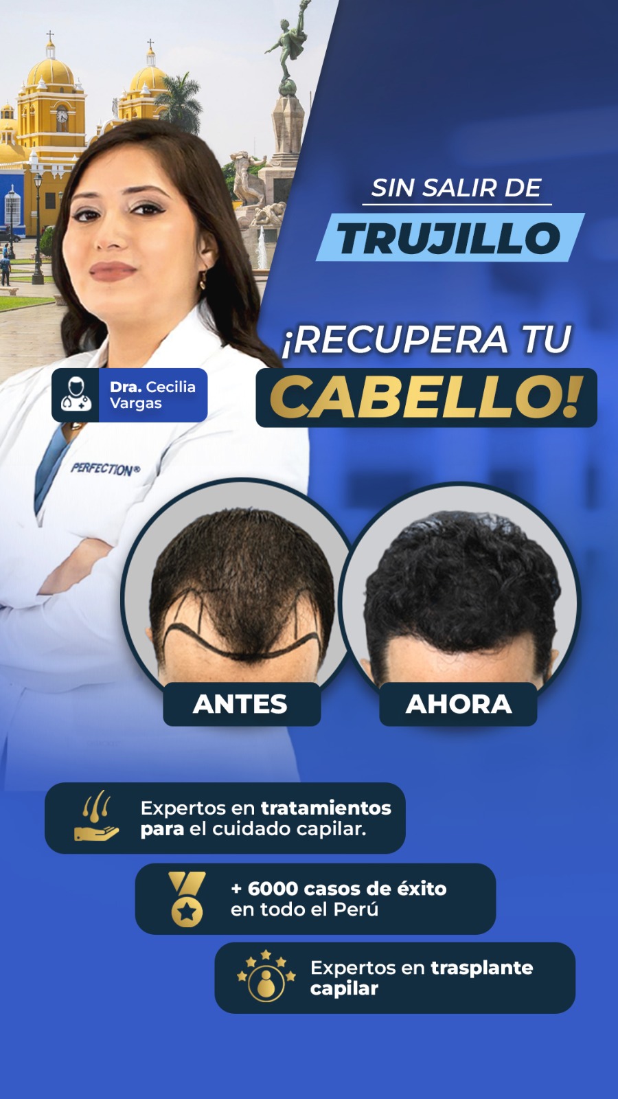 Perfection capilar - Trasplante capilar Facebook ad from Mar 1, 2026