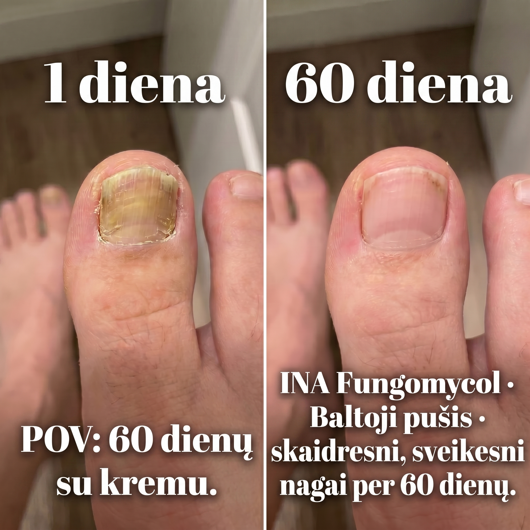 InaEssentials.lt - Organinė Kosmetika Facebook ad: 1 diena prieš 60 dieną: pamatyk skirtumą
