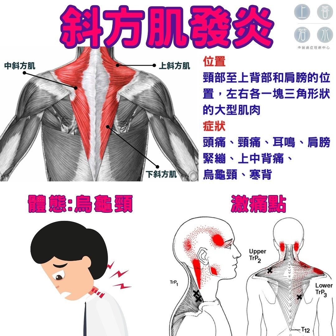 上善若水中醫痛症理療中心 Mercy Chinese Medicine Clinic 筋膜痛症 Chronic Pain Treatment Facebook ad