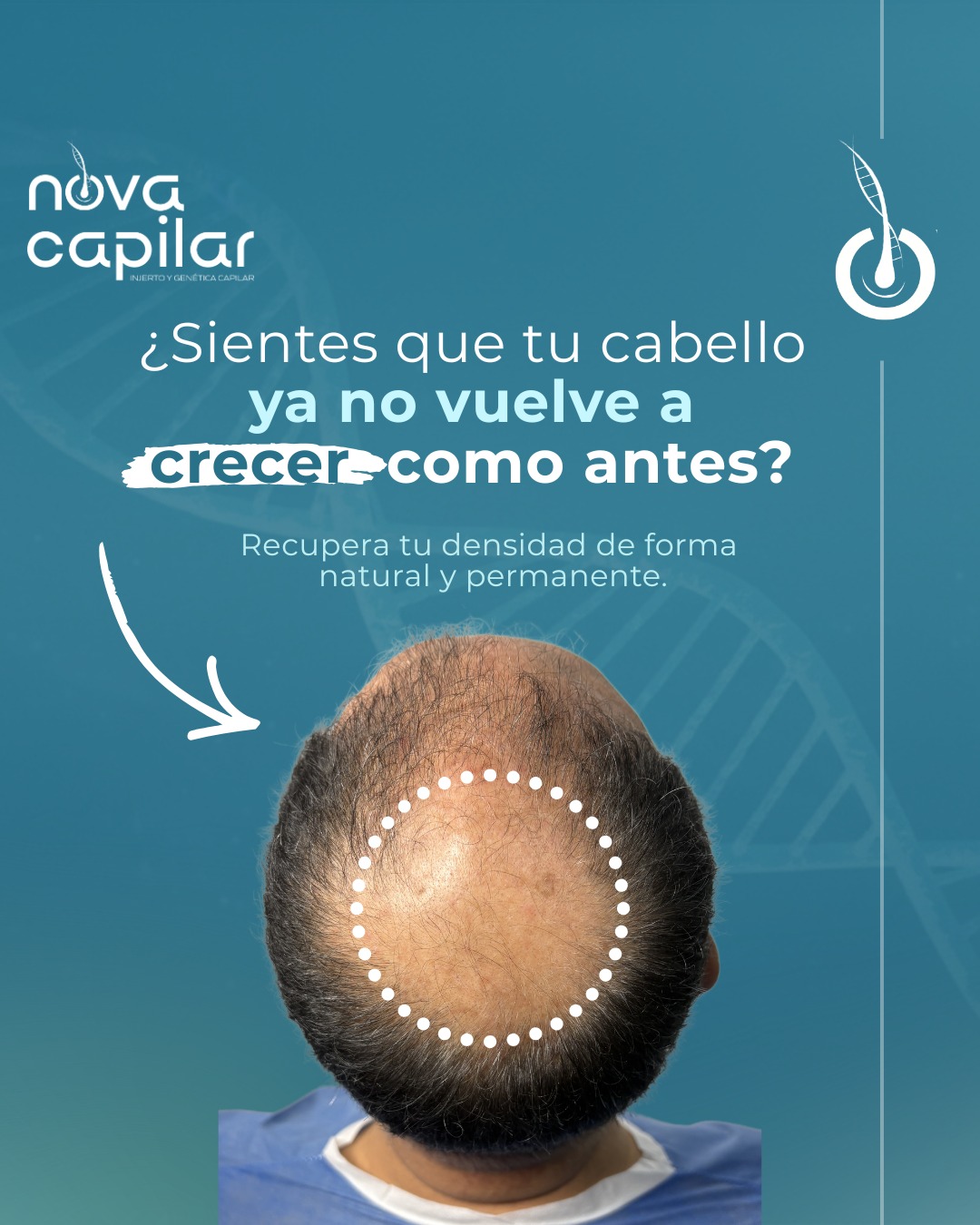 NOVA Capilar Regenerativa Facebook ad: Recuperar tu cabello sí es posible