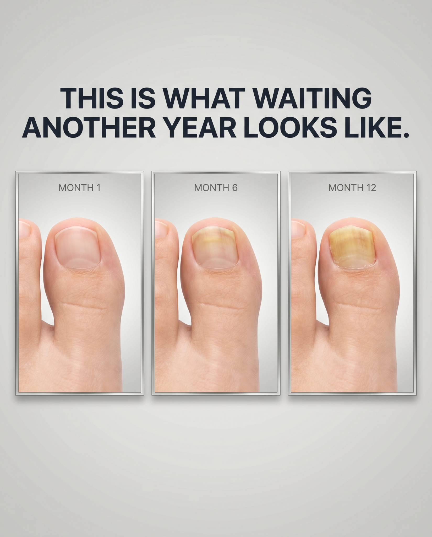 Dermachom Facebook ad: No Pills. No Prescription. No Liver Risk.