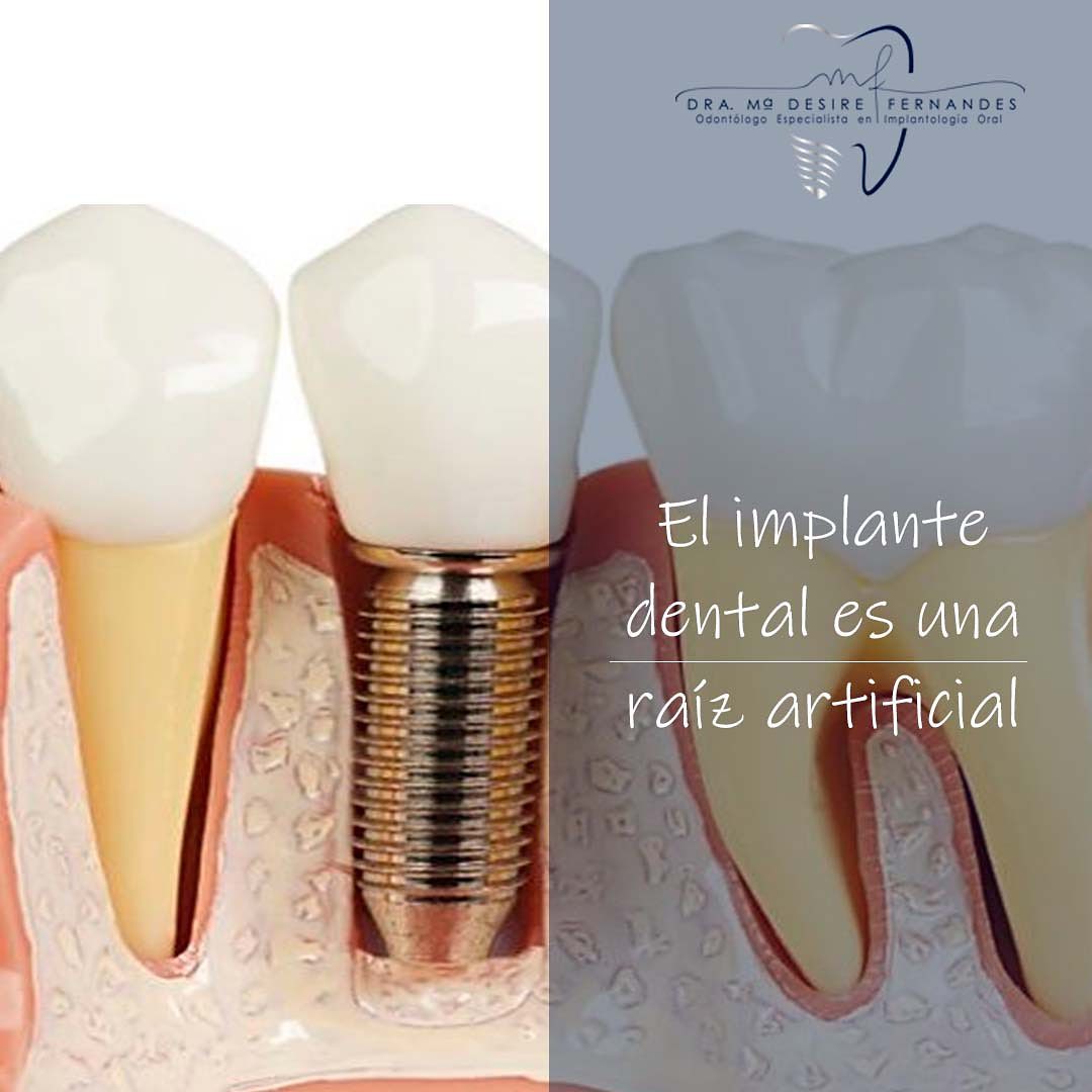od.desirefernandes Facebook ad: Reemplace sus dientes perdidos con el tratamiento avanzado…