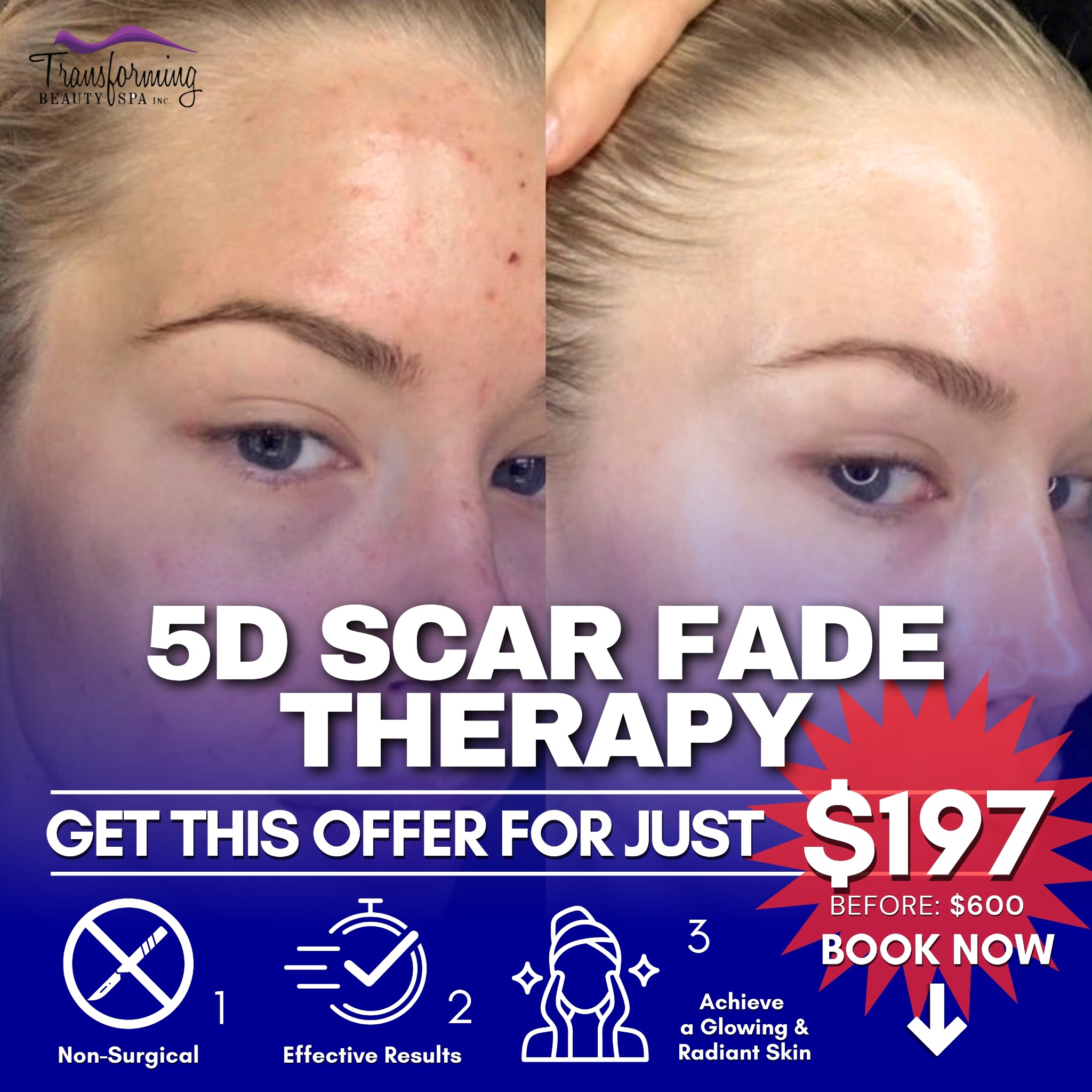 Transforming Beauty Facebook ad: 5D Scar Fade Therapy For $197 Only