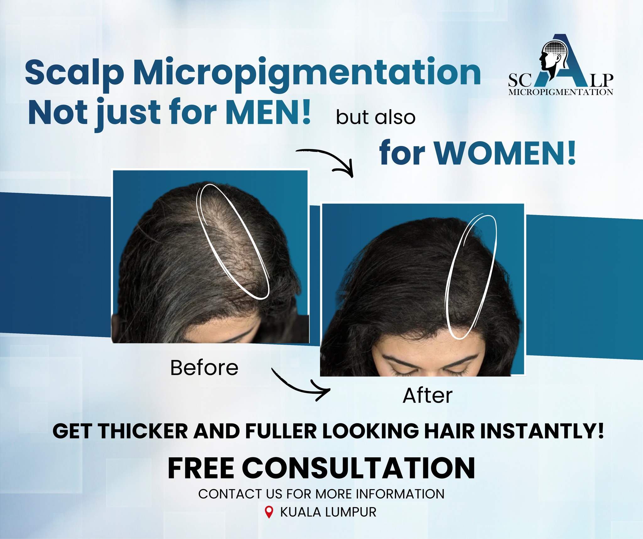 Advanced Scalp Micropigmentation Facebook ad: Scalp Micropigmentation (SMP), Now for Women Too!