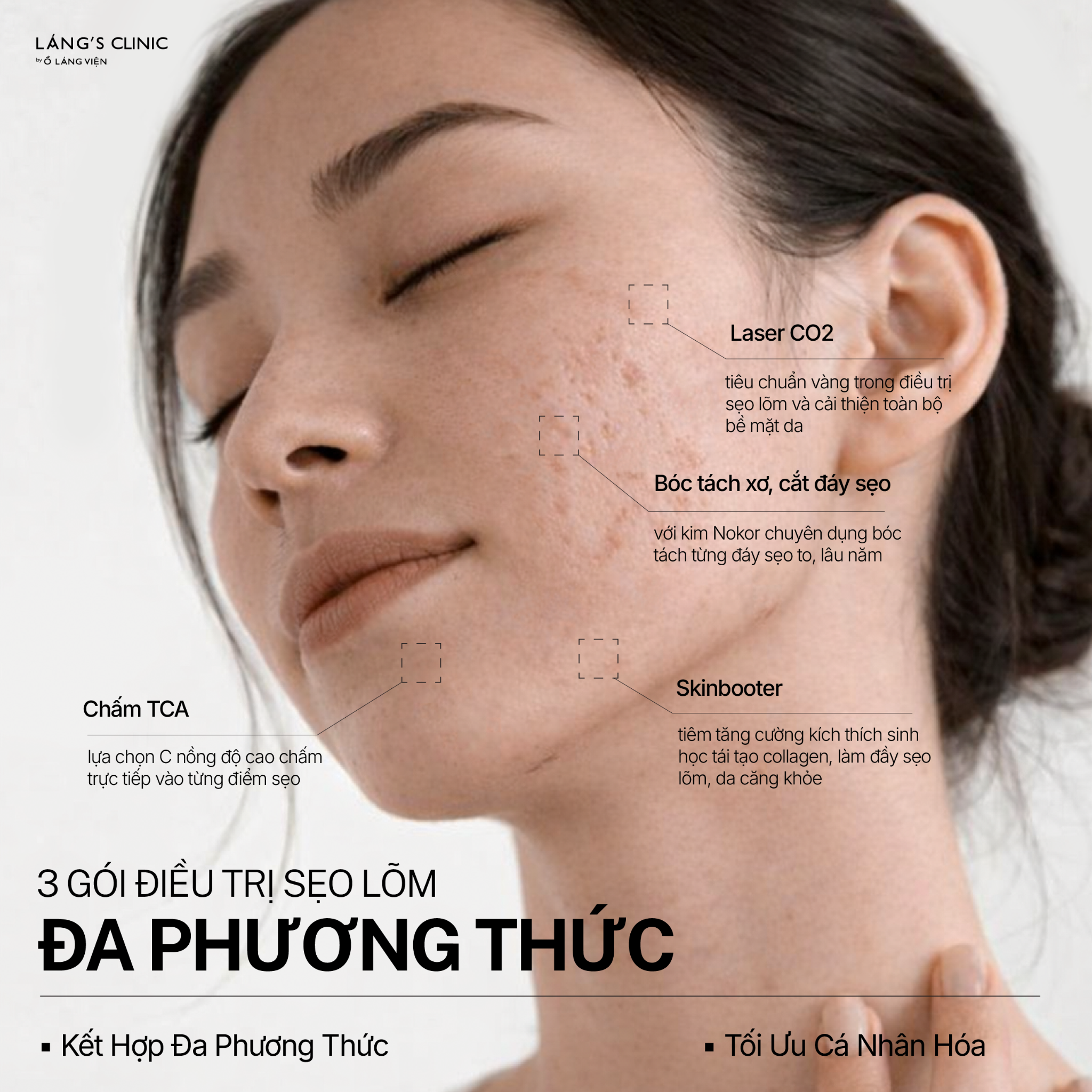 Ồ Láng Viện Facebook ad
