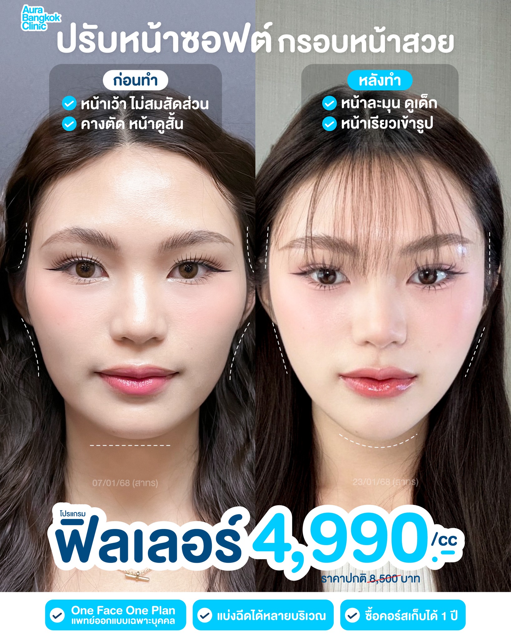 Aura Bangkok Clinic TH Facebook ad