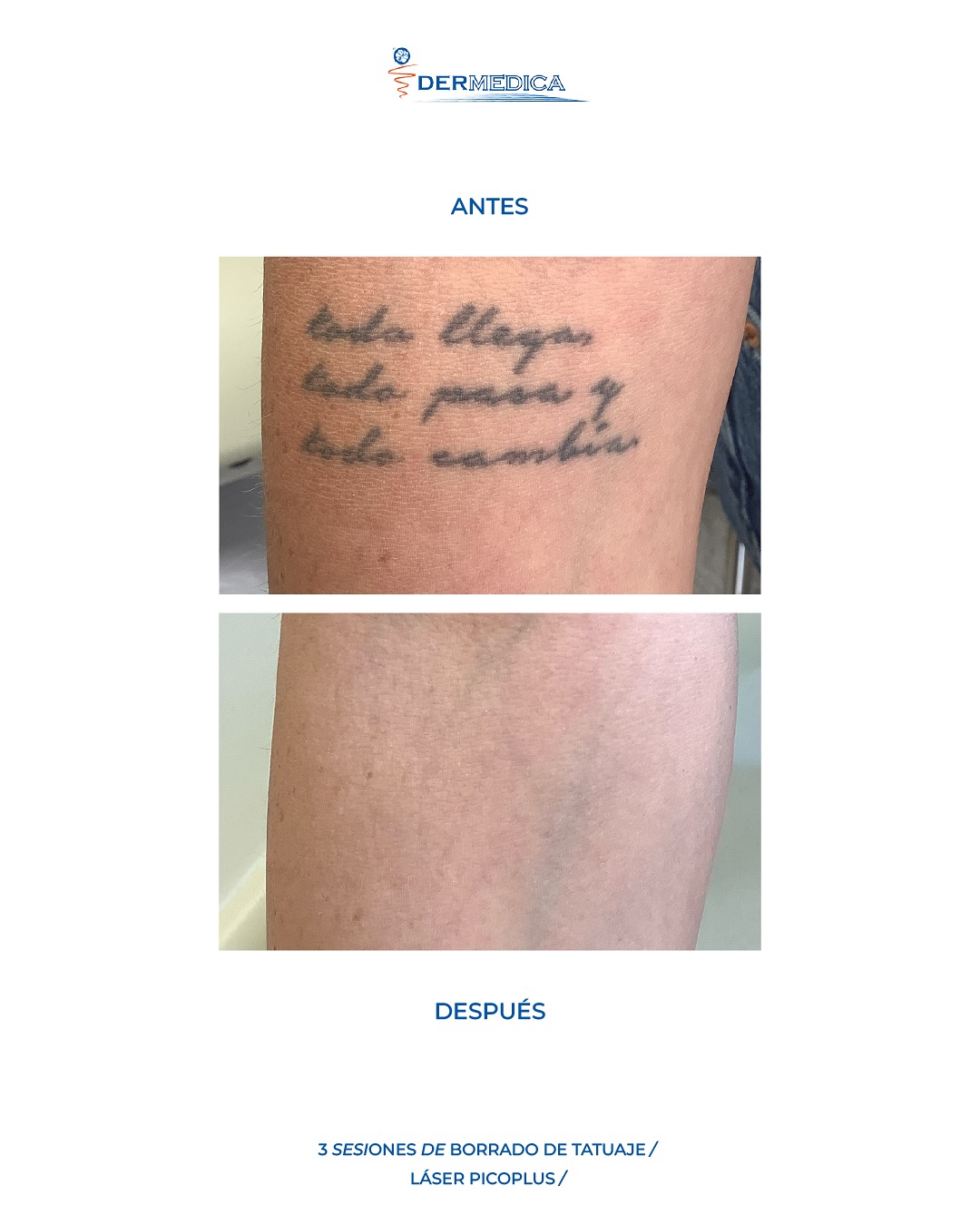 Dermedica - Clínica de Dermatología Cosmética Facebook ad: Resultados que hablan por sí solos