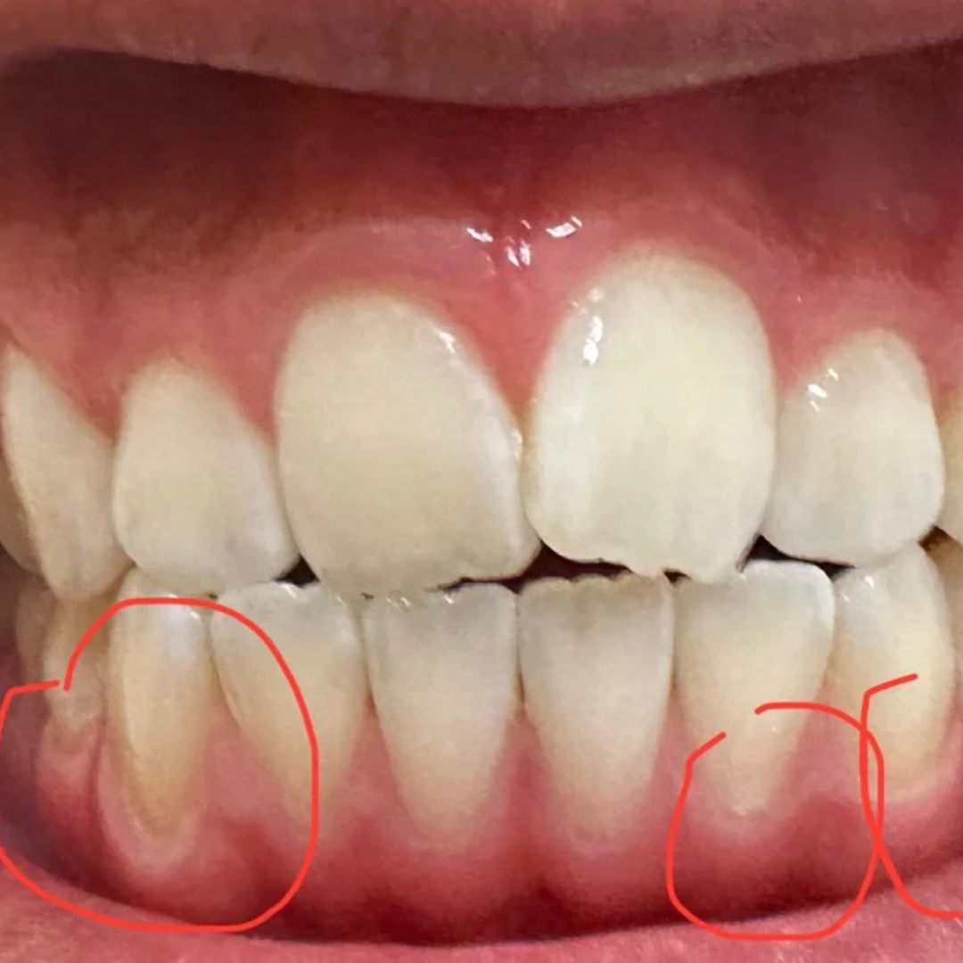 Ma sante blog Facebook ad: Votre dentiste surveille vos gencives? Voici pourquoi…