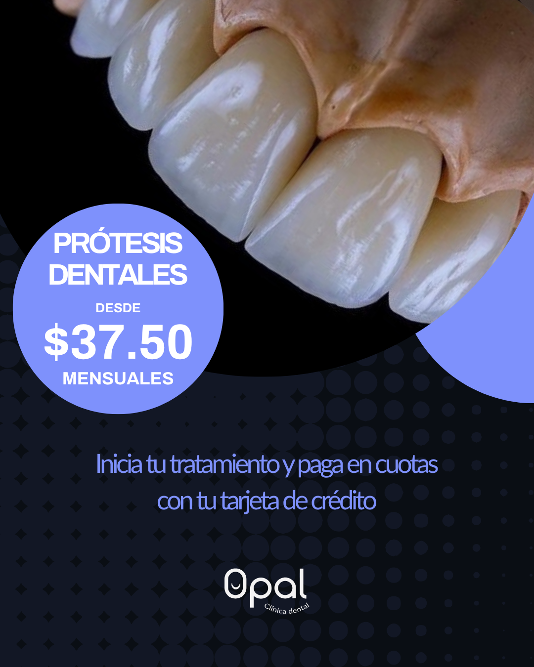 Opal Clínica Dental Facebook ad