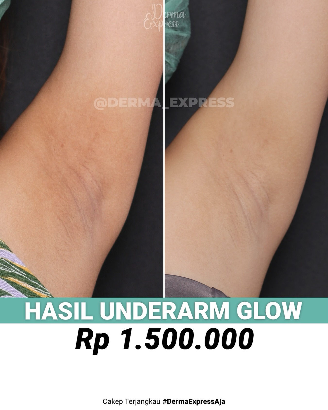 derma_express Facebook ad