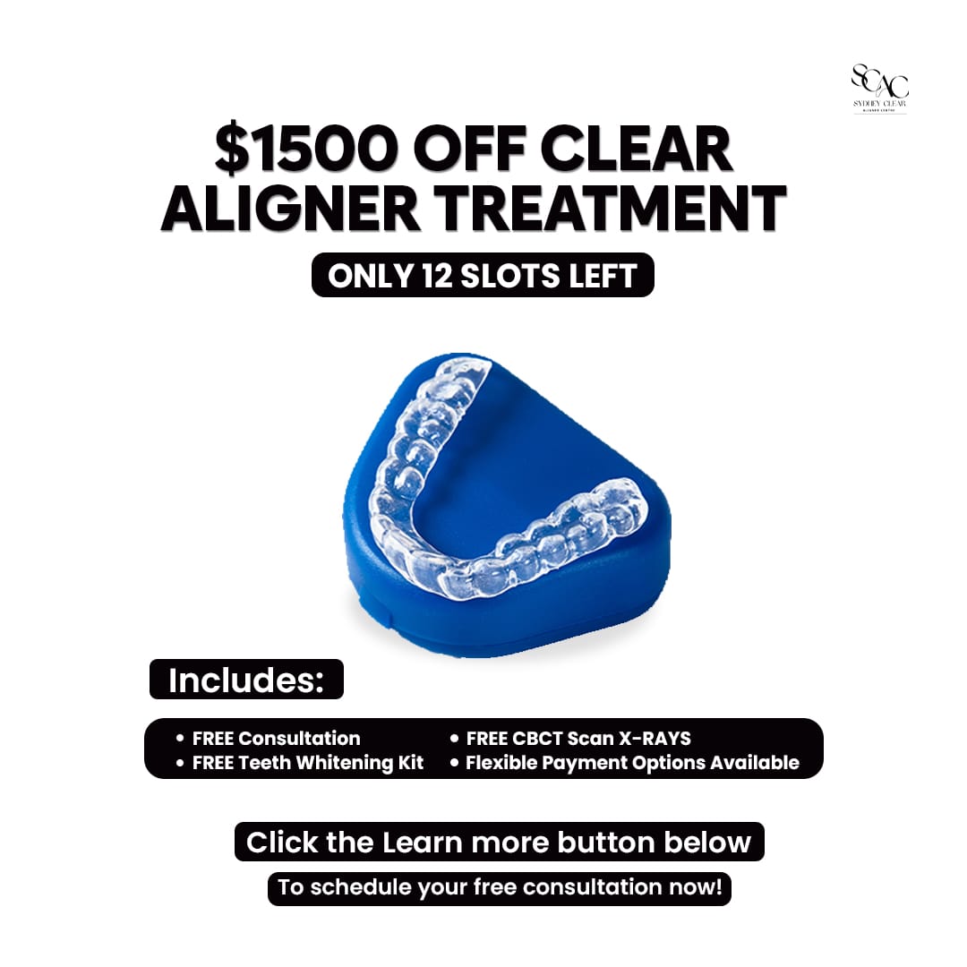 Sydney Clear Aligner Centre Facebook ad: $1500 Off On Clear Aligners + Free Whitening Kit!