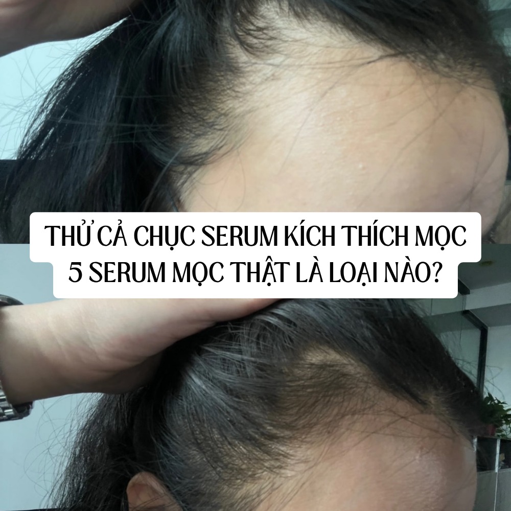 Kiếp nạn Skincare Facebook ad
