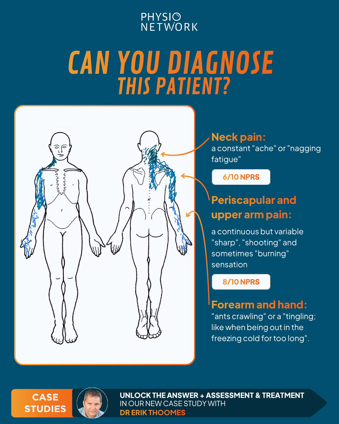 Physio Network Facebook ad: Watch In-Depth Case Study!