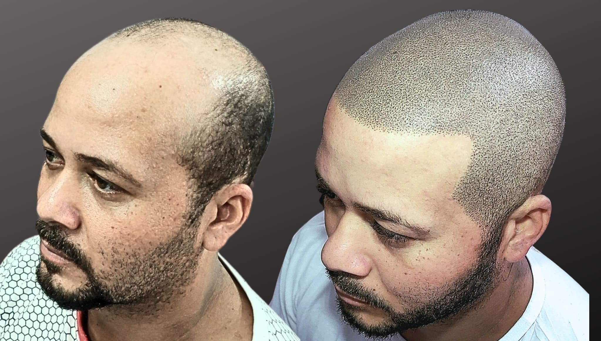 IN LINE estética e micropigmentação Facebook ad