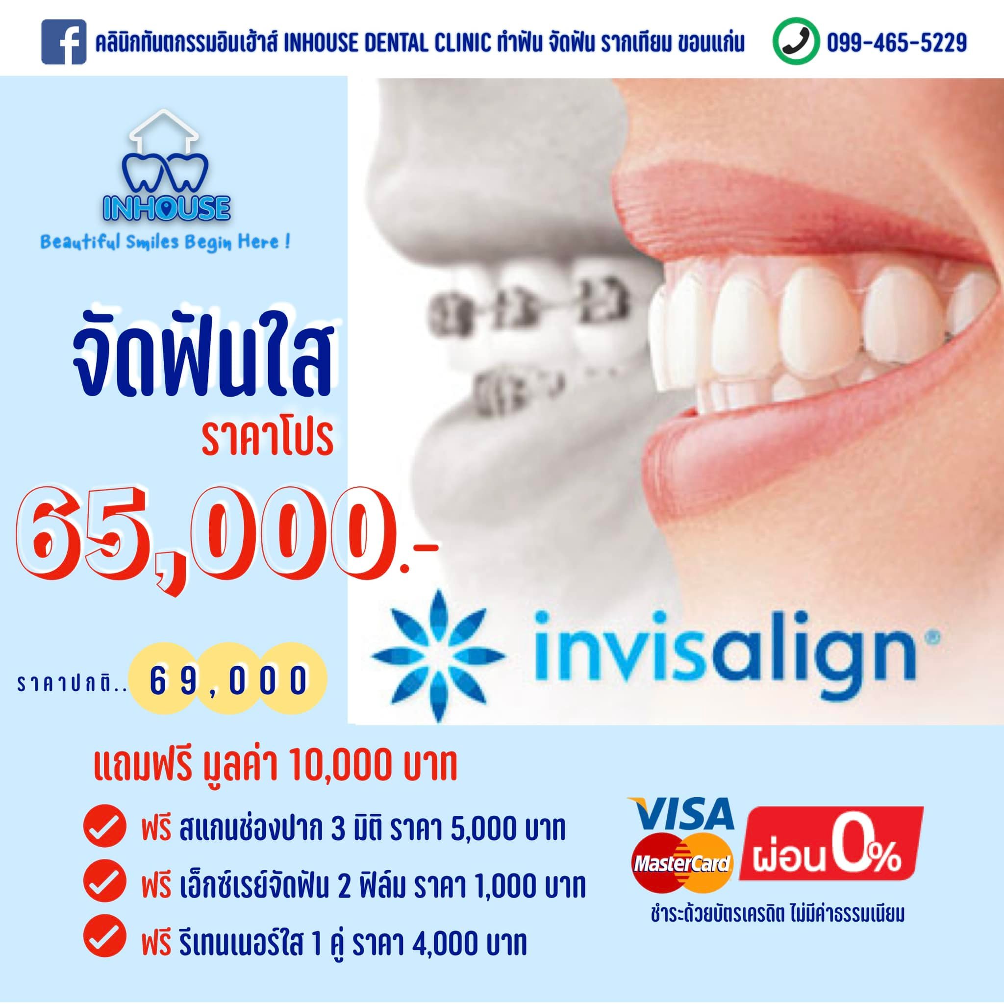 คลินิกทันตกรรมอินเฮ้าส์ Inhouse Dental Clinic ทำฟัน จัดฟัน รากเทียม ขอนแก่น Facebook ad