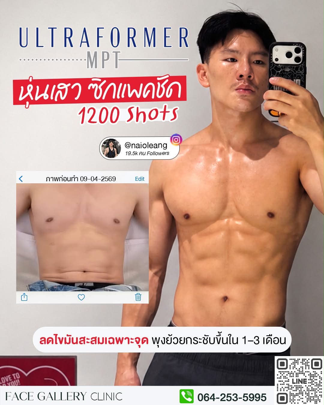 FaceGallery Clinic Facebook ad: สร้างหุ่นเสว! ด.ช. โอ เลี้ยง ออกกำลังกาย 90% อีก 10%…