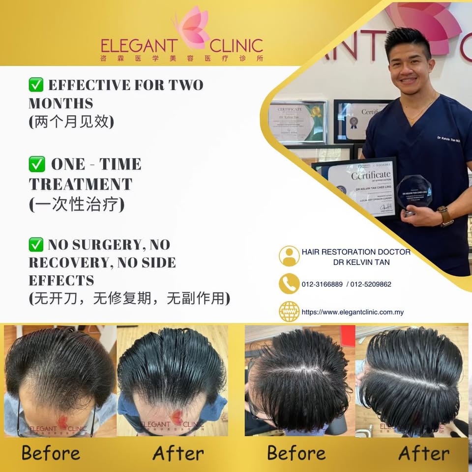 Elegant Clinic Malaysia Facebook ad: Aesthetic Clinic and ons stop Hair medical Clinic…