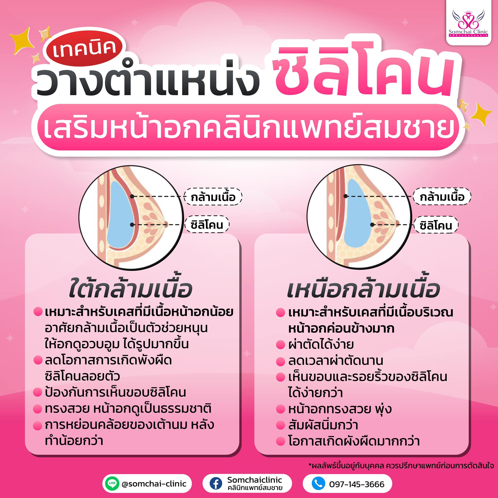 Somchaiclinic คลินิกแพทย์สมชาย Facebook ad