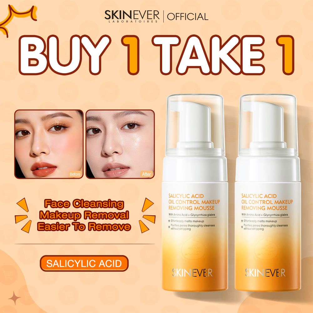 Skinever Facebook ad