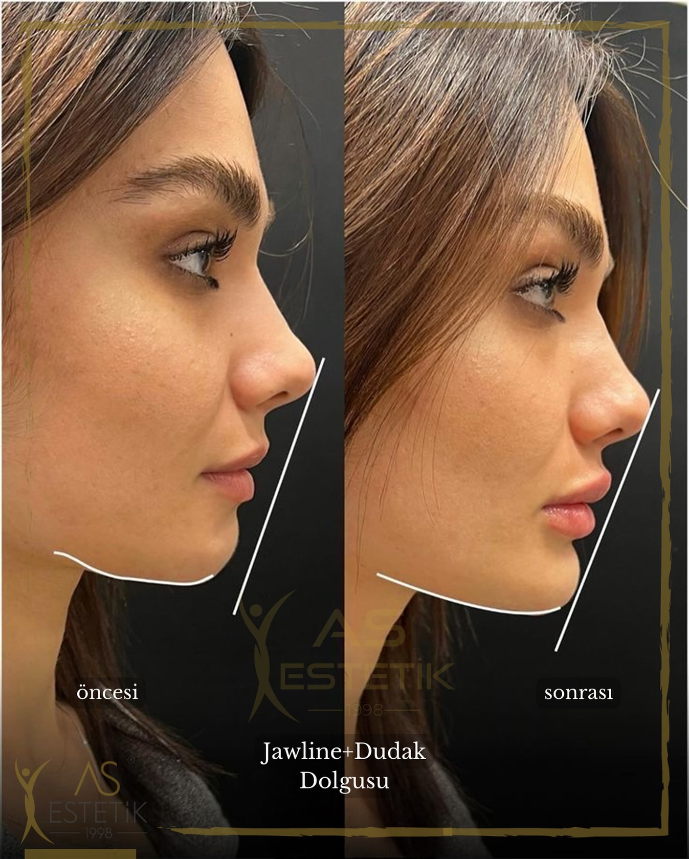 As Estetik&Güzellik Facebook ad: Daha Keskin Daha Dinamik